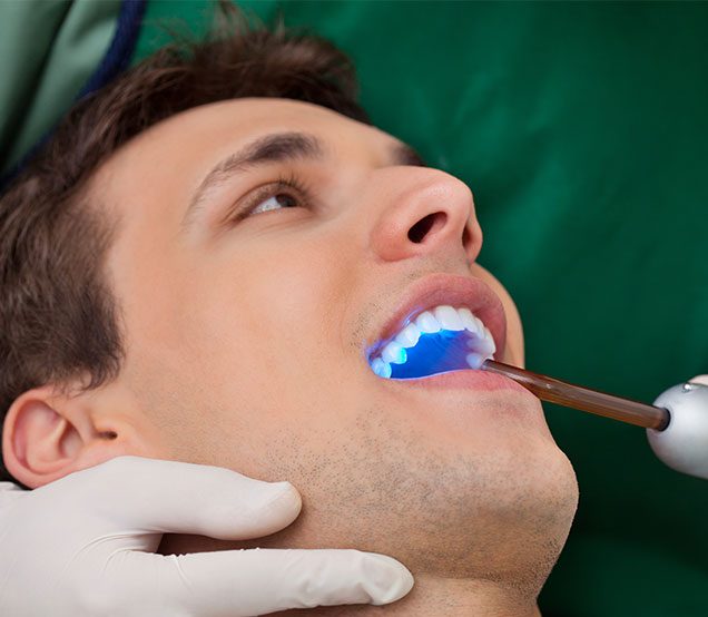 Calgary Dental Bonding | SE Calgary General Dentist | Cranston Dental Centre | Calgary AB